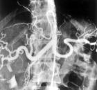 angiografia.jpg